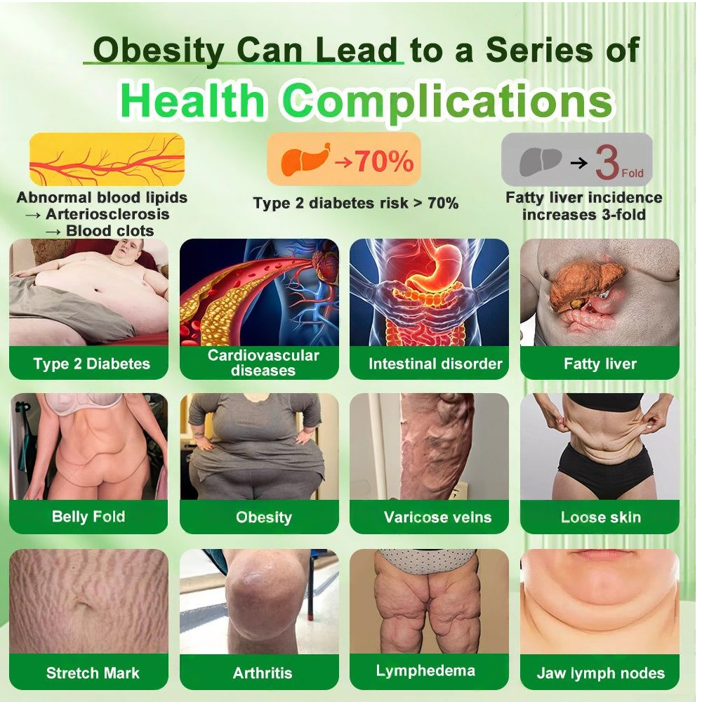 🔥New Arrival | Croaie® 𝗚𝗟𝗣-𝟭 𝟐𝟎-𝐢𝐧-𝟏 𝐒𝐥𝐢𝐦& 𝑯𝒆𝒂𝒍𝒕𝒉𝐲 𝑶𝒓𝒂𝒍 𝑺𝒐𝒍𝒖𝒕𝒊𝒐𝒏 𝑂𝑛𝑐𝑒 𝑎 𝑑𝑎𝑦, 𝑣𝑖𝑠𝑖𝑏𝑙𝑒 𝑟𝑒𝑠𝑢𝑙𝑡𝑠 𝑖𝑛 7 𝑑𝑎𝑦𝑠  ✅ 𝗦𝘂𝗽𝗽𝗼𝗿𝘁𝘀 𝗼𝗯𝗲𝘀𝗶𝘁𝘆, 𝗰𝗮𝗿𝗱𝗶𝗼𝘃𝗮𝘀𝗰𝘂𝗹𝗮𝗿 𝗵𝗲𝗮𝗹𝘁𝗵, 𝗱𝗶𝗮𝗯𝗲𝘁𝗲𝘀, 𝘀𝗹𝗲𝗲𝗽 𝗮𝗽𝗻𝗲𝗮, 𝗴𝘂𝘁 𝗵𝗲𝗮𝗹𝘁𝗵, 𝗷𝗼𝗶𝗻𝘁 𝗶𝘀𝘀𝘂𝗲𝘀, 𝐰𝐡𝐢𝐥𝐞 𝐚𝐥𝐬𝐨 𝐟𝐢𝐫𝐦𝐢𝐧𝐠 𝐭𝐡𝐞 𝐬𝐤𝐢𝐧 𝐚𝐧𝐝 𝐛𝐨𝐨𝐬𝐭𝐢𝐧𝐠 𝐞𝐧𝐞𝐫𝐠𝐲.🎁